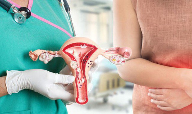 Người phụ nữ bị ung thư phải cắt bỏ cơ quan sinh dục vì xấu hổ không đi khám phụ khoa - 2